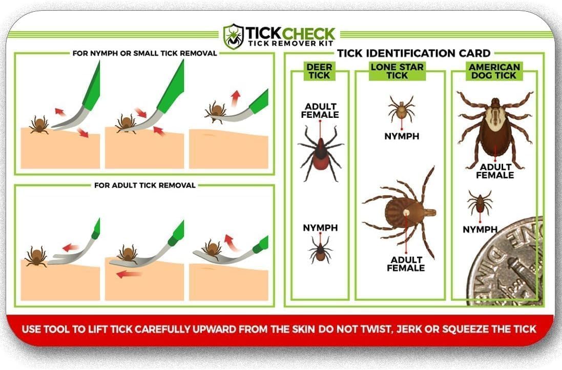 TickCheck Premium Tick Remover Kit - Stainless Steel Tick Remover + Tweezers, Leather Case, and Free Pocket Tick Identification Card (1 Set)