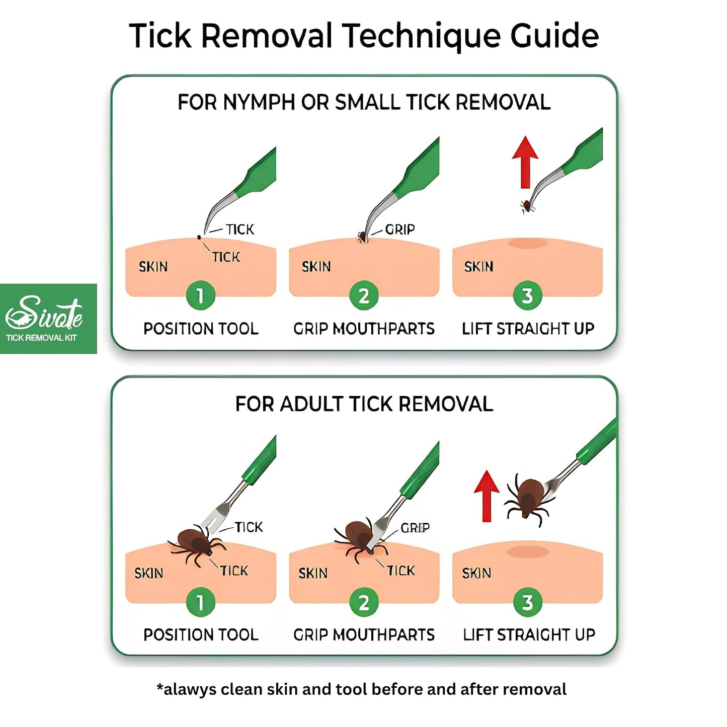 Premium Tick Remover Kit – Stainless Steel Tool with Case, Safe for Pets